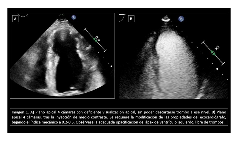 Imagen 1