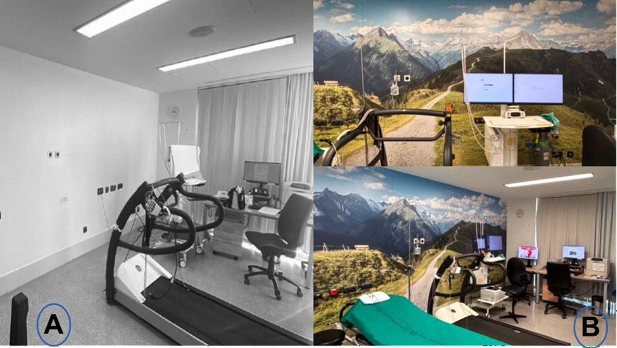 Figura 1. Sala de ergoespirometría antes y después de la intervención de humanización con recursos visuales de naturaleza: (A) paredes blancas; (B) instalación de vinilos de paisaje natural.